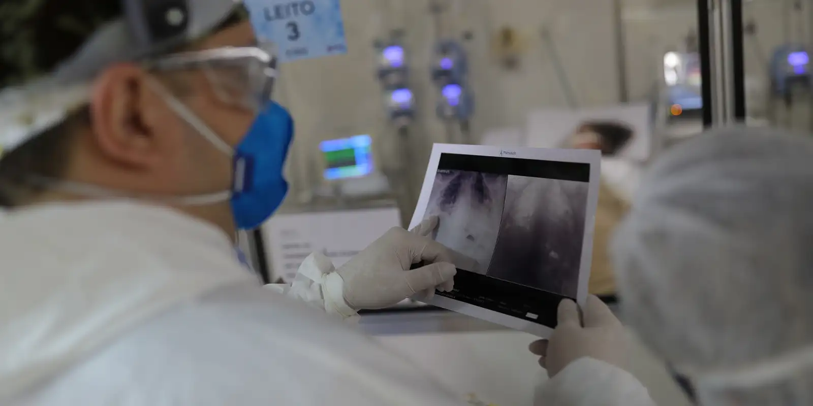 Broncopneumonia: entenda quadro que causou internação de Bolsonaro